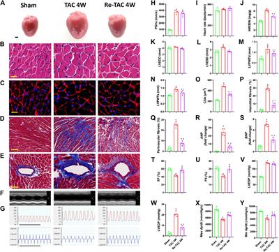 Caspase-1 Abrogates the Salutary Effects of Hypertrophic Preconditioning in Pressure Overload Hearts via IL-1β and IL-18